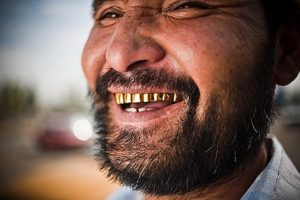 Сонник Золоті Зуби у іншої людини бачити уві сні до чого сняться?