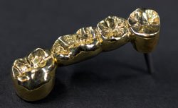 Сонник Золоті Зуби у іншої людини бачити уві сні до чого сняться?
