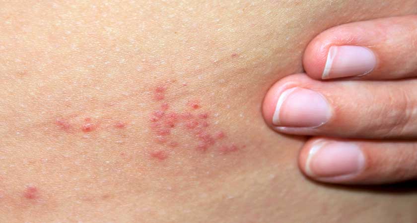 Личинки клопів   домашніх і постільних, як виглядають на фото