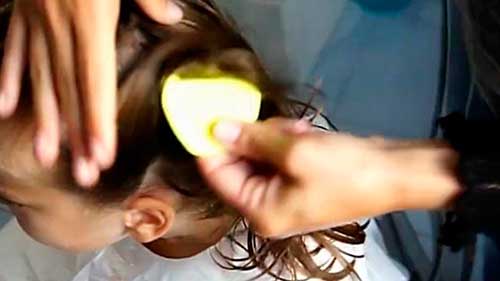 Воші у дитини   що робити, як лікувати в домашніх умовах