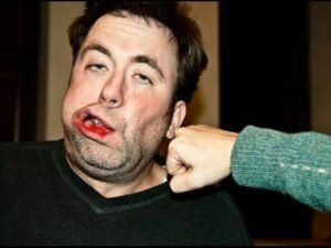 Сонник Випали Вставні Зуби з кровю і без у сні бачити