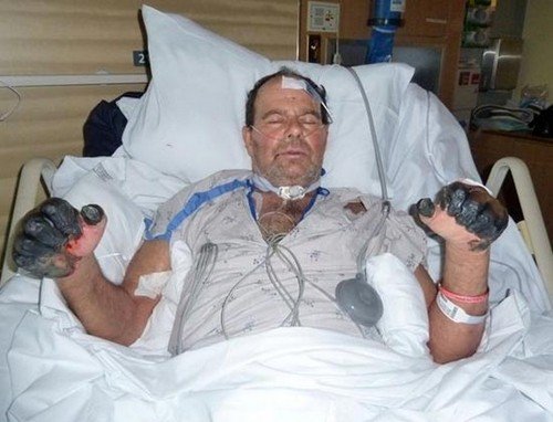 Людська блоха: фото, поширювані захворювання і як позбутися