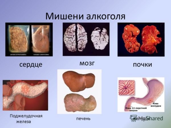 Який спирт можна пити: етиловий, чистий медичний або шкідливий метиловий?