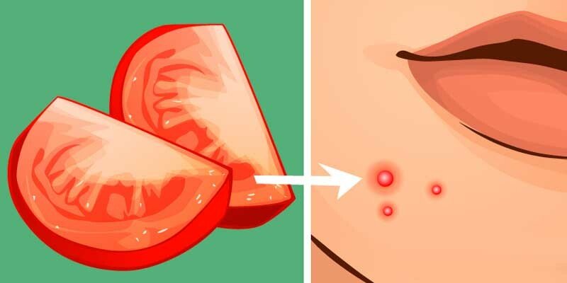 Маска з помідорів для обличчя від зморшок: властивості і користь Маска з помідорів для обличчя від зморшок: властивості і користь