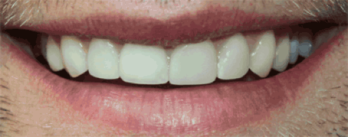 До чого сниться як ростуть зуби — ТОП 35 значень